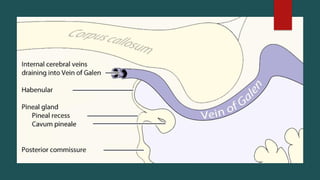 pineal gland tumors ( pineal gland )- approach | PPTX