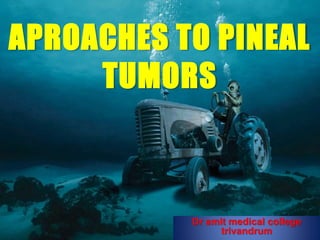APROACHES TO PINEAL
TUMORS
Dr amit medical college
trivandrum
 