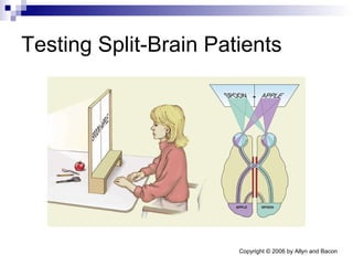 Testing Split-Brain Patients  