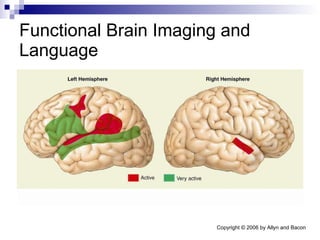 Functional Brain Imaging and Language 