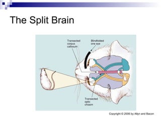 The Split Brain 