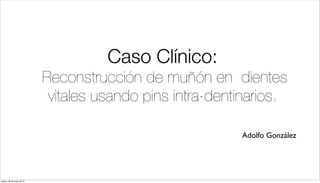 Caso Clínico:
Reconstrucción de muñón en dientes
vitales usando pins intra-dentinarios.
Adolfo González
jueves, 30 de mayo de 13
 
