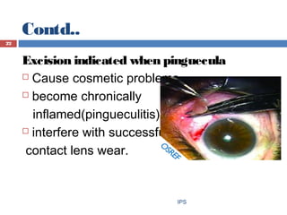 IPS
22
Excision indicated when pinguecula
 Cause cosmetic problems
 become chronically
inflamed(pingueculitis)
 interfe...