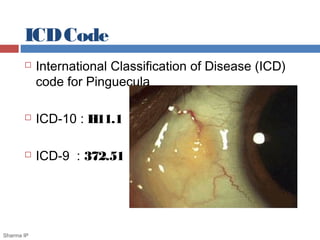ICDCode
 International Classification of Disease (ICD)
code for Pinguecula
 ICD-10 : H11.1
 ICD-9 : 372.51
Sharma IP
 