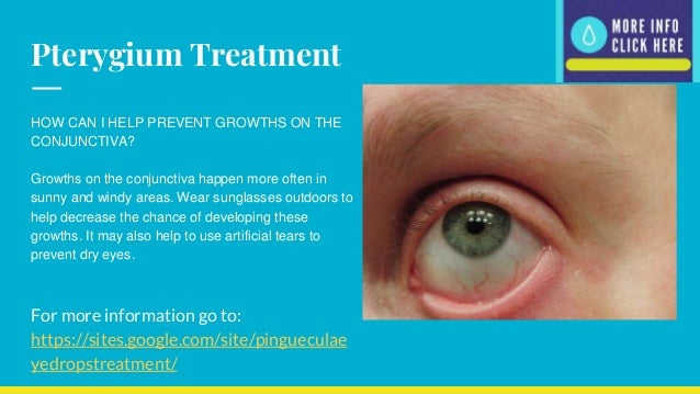 Pinguecula Eye Drops With Dipyridamole Pinguecula Eye Drops With Dipyridamole