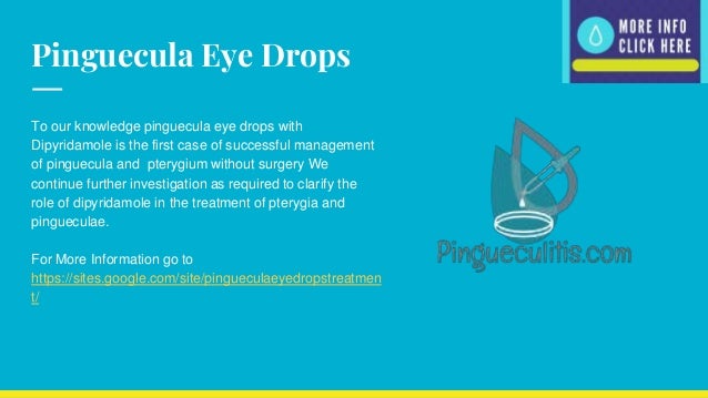 Pinguecula Eye Drops What Is A Pinguecula Limmerkoll Pinguecula Eye Drops What Is A Pinguecula Limmerkoll