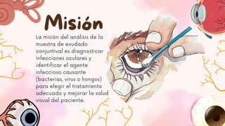 Misión
La misión del análisis de la
muestra de exudado
conjuntival es diagnosticar
infecciones oculares y
identificar el agente
infeccioso causante
(bacterias, virus o hongos)
para elegir el tratamiento
adecuado y mejorar la salud
visual del paciente.
 