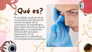 ¿Qué es?
El exudado conjuntival es
una muestra de secreción
ocular tomada de la
conjuntiva (la membrana
que cubre el interior de los
párpados y la superficie
blanca del ojo) para
examinarla en el
laboratorio e identificar
microorganismos presentes.
 