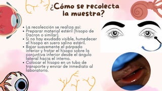 ¿Cómo se recolecta
la muestra?
La recolección se realiza así:
Preparar material estéril (hisopo de
Dacron o similar).
Si no hay exudado visible, humedecer
el hisopo en suero salino estéril.
Bajar suavemente el párpado
inferior y frotar el hisopo sobre la
conjuntiva inferior desde el ángulo
lateral hacia el interno.
Colocar el hisopo en un tubo de
transporte y enviar de inmediato al
laboratorio.
 