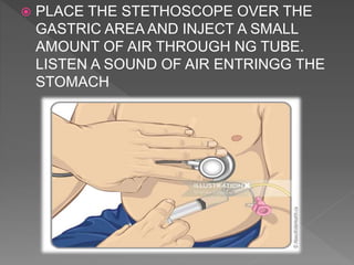 Ng Tube Practice Pinkcity nursing classes ng tube | PPTX