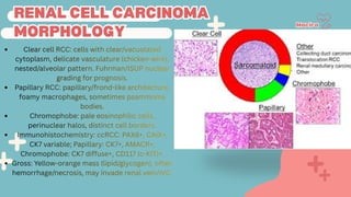 Comprehensive Overview of Renal Cell Carcinoma in Oncology | PDF