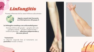 Linfangitis Reticular Comprehensive Overview of Bacterial Skin Infections and Treatments | PDF