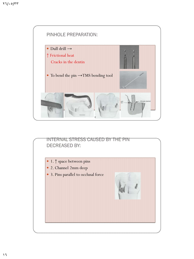 Pin retained amalgam restorations