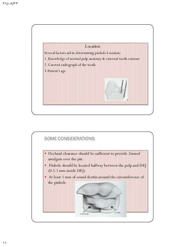 Pin retained amalgam restorations