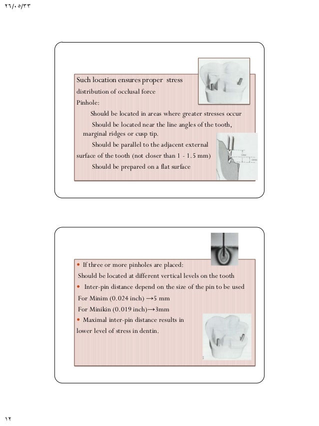 Pin retained amalgam restorations