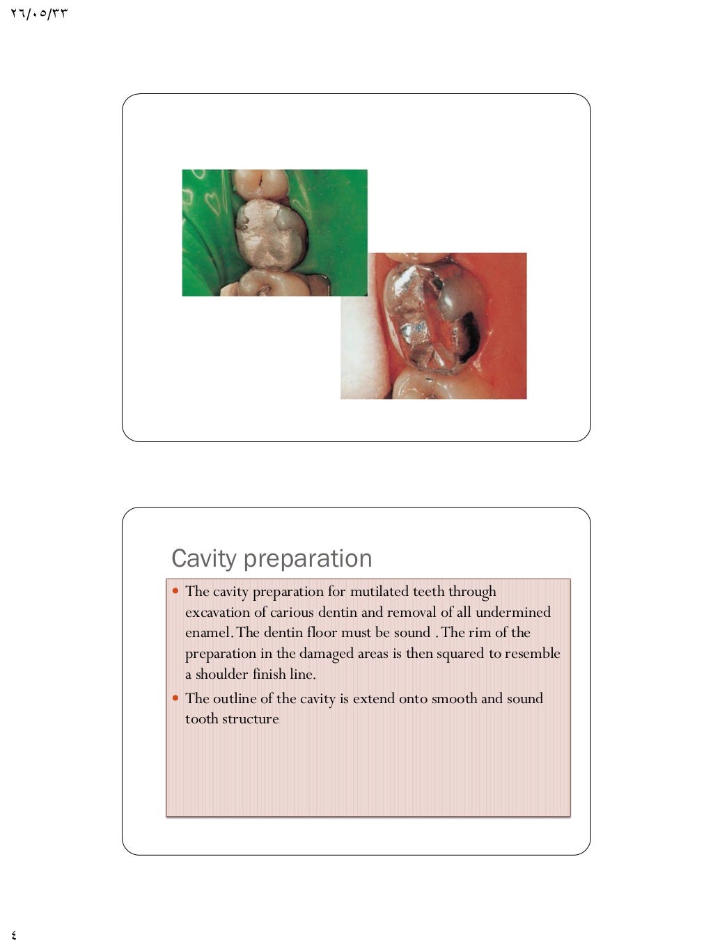 Pin retained amalgam restorations