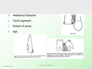 Pin Retaing Feature Pin retained restorations | PPTX
