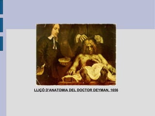 LLIÇÓ D'ANATOMIA DEL DOCTOR DEYMAN, 1656 