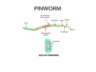Pinworm_Presentation_Final_With_Images_Dr_R_N_Rani.pptx