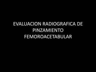 EVALUACION RADIOGRAFICA DE 
PINZAMIENTO 
FEMOROACETABULAR 
 