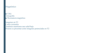 Diagnóstico
■ USG
Artrografía
■ Resonancia magnética
Imagenes en T2
Cortes coronales
Tendones mantienen una señal baja
Roturas se presentar como imagenes potenciadas en T2
 