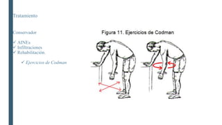 Tratamiento
Conservador
 AINEs
 Infiltraciones
 Rehabilitación.
 Ejercicios de Codman
 