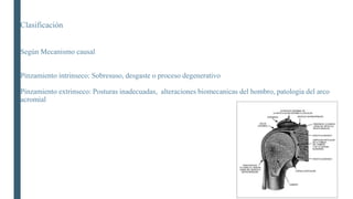 Clasificación
Según Mecanismo causal
Pinzamiento intrinseco: Sobresuso, desgaste o proceso degenerativo
Pinzamiento extrinseco: Posturas inadecuadas, alteraciones biomecanicas del hombro, patologia del arco
acromial
 