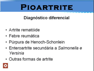 Pioartrite 