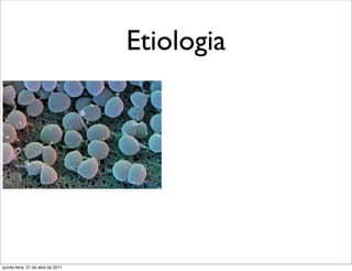 Etiologia




quinta-feira, 21 de abril de 2011
 