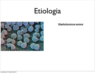 Etiologia
                                            Staphylococcus aureus




quinta-feira, 21 de abril de 2011
 