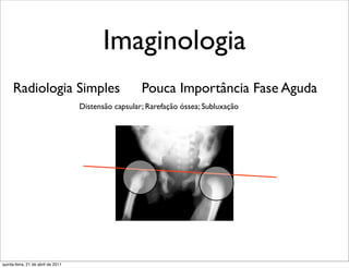 Imaginologia
     Radiologia Simples                               Pouca Importância Fase Aguda
                                    Distensão capsular; Rarefação óssea; Subluxação




quinta-feira, 21 de abril de 2011
 