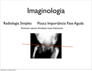 Imaginologia
     Radiologia Simples                               Pouca Importância Fase Aguda
                                    Distensão capsular; Rarefação óssea; Subluxação




quinta-feira, 21 de abril de 2011
 