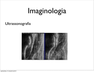 Imaginologia
         Ultrassonograﬁa




quinta-feira, 21 de abril de 2011
 