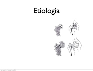 Etiologia




quinta-feira, 21 de abril de 2011
 