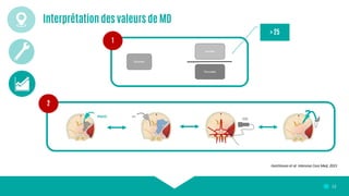 Pioche Pierre-Antoine - Microdialyse cérébrale | PDF