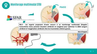 Pioche Pierre-Antoine - Microdialyse cérébrale | PDF