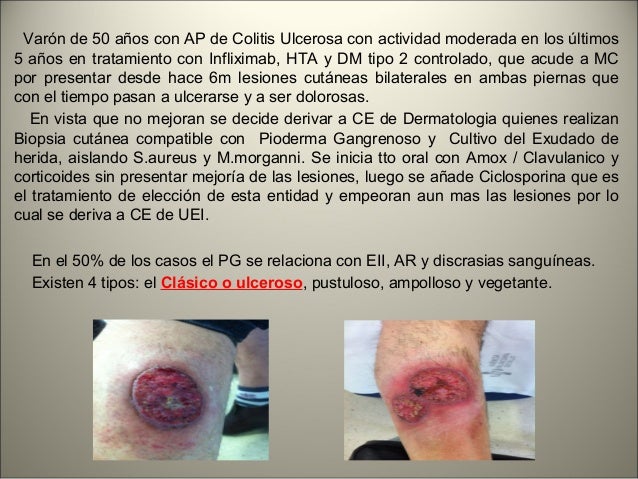 Pioderma gangrenoso