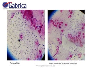 Neutrófilos Imagen tomada por: Dr Fernando Gamba CUV
 