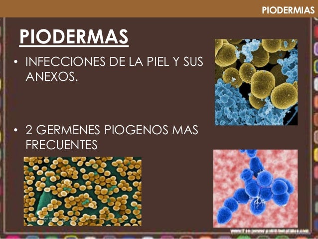 Piodermias dermatología