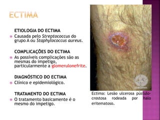 ETIOLOGIA DO ECTIMA
 Causada pelo Streptococcus do
grupo A ou Staphylococcus aureus.
COMPLICAÇÕES DO ECTIMA
 As possíveis complicações são as
mesmas do impetigo,
particularmente a glomerulonefrite.
DIAGNÓSTICO DO ECTIMA
 Clínico e epidemiológico.
TRATAMENTO DO ECTIMA
 O tratamento basicamente é o
mesmo do impetigo.
Ectima: Lesão ulcerosa pústulo-
crostosa rodeada por halo
eritematoso.
 