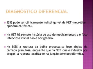  SSSS pode ser clinicamente indistinguível da NET (necrólise
epidérmica tóxica).
 Na NET há sempre história de uso de medicamentos e o foco
infeccioso inicial não é obrigatório.
 Na SSSS a ruptura da bolha processa-se logo abaixo da
camada granulosa, enquanto que na NET, que é induzida por
drogas, a ruptura localiza-se na junção dermoepidérmica.
 