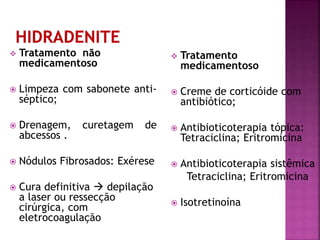  Tratamento não
medicamentoso
 Limpeza com sabonete anti-
séptico;
 Drenagem, curetagem de
abcessos .
 Nódulos Fibrosados: Exérese
 Cura definitiva  depilação
a laser ou ressecção
cirúrgica, com
eletrocoagulação
 Tratamento
medicamentoso
 Creme de corticóide com
antibiótico;
 Antibioticoterapia tópica:
Tetraciclina; Eritromicina
 Antibioticoterapia sistêmica
Tetraciclina; Eritromicina
 Isotretinoína
 