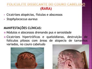  Cicatrizes alopécias, fístulas e abscessos
 Staphylococcus aureus
MANIFESTAÇÕES CLÍNICAS:
 Nódulos e abscessos drenando pus e serosidade
 Cicatrizes hipertróficas e queloidianas, destruição de
folículos pilosos com áreas de alopecia de tamanhos
variados, no couro cabeludo
 