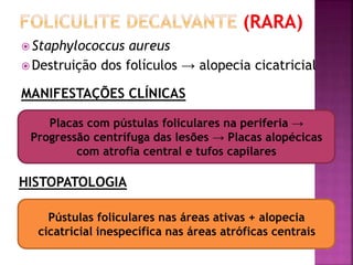 Staphylococcus aureus
 Destruição dos folículos → alopecia cicatricial
MANIFESTAÇÕES CLÍNICAS
Placas com pústulas foliculares na periferia →
Progressão centrífuga das lesões → Placas alopécicas
com atrofia central e tufos capilares
Pústulas foliculares nas áreas ativas + alopecia
cicatricial inespecífica nas áreas atróficas centrais
HISTOPATOLOGIA
 
