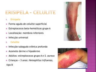 1. Erisipela
 Forma aguda de celulite superficial
 Estreptococos beta-hemolítcos grupo A
 Localização: membros inferiores
 Infecção universal
2. Celulite
 Infecção subaguda crônica profunda
 Acomete derme e hipoderme
 Adultos: estreptococos grupo A e S. aureus
 Crianças < 3 anos: Hemophilus influenza,
tipo B
 