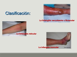 Linfangitis Reticular Piodermitis y ectoparasitos | PPT