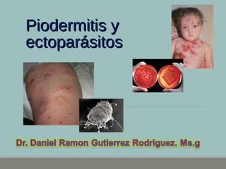 Piodermitis yPiodermitis y
ectoparásitosectoparásitos
 