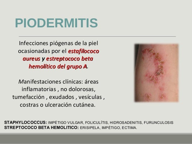 Piodermitis y ectoparasitos