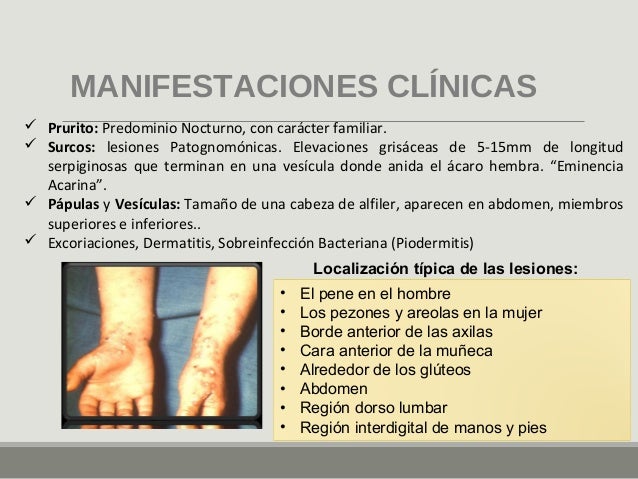 Piodermitis y ectoparasitos