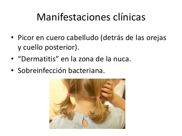 La psoriasis en la zona del bikini